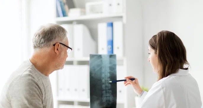 Espondilite anquilosante: inflamação que compromete coluna exige diagnóstico precoce - Imagem do artigo