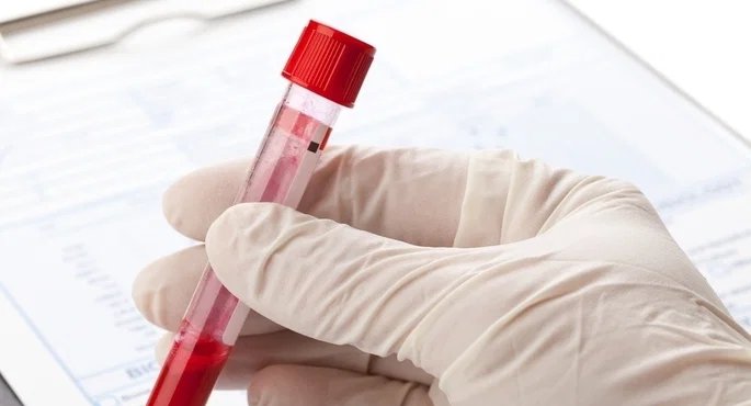 Curva glicêmica: teste mede tolerância à glicose e ajuda a detectar diabetes e resistência à insulina - Imagem do artigo