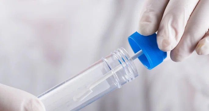 Teste imunoquímico fecal identifica sangue oculto e apoia rastreamento do câncer colorretal - Imagem do artigo