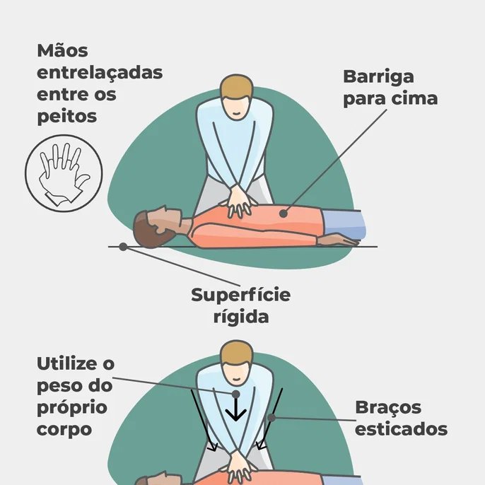 Parada cardiorrespiratória: entenda sintomas, causas e como agir em emergências - Imagem do artigo